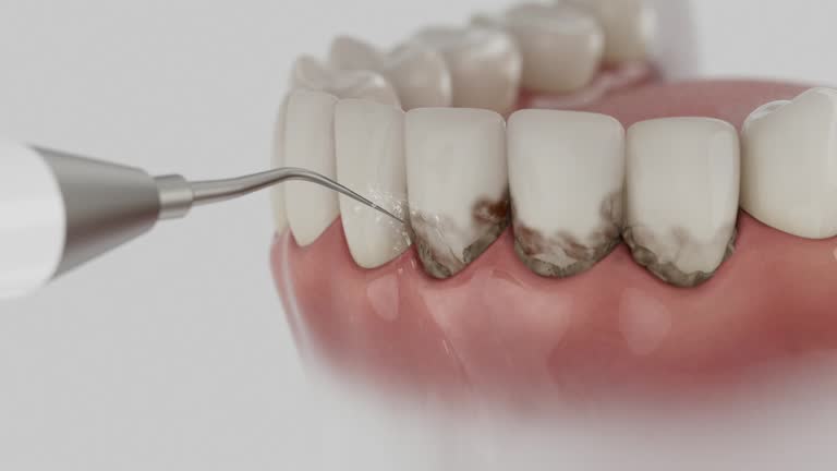 Trusted Teeth Cleaning And Checkup service in Haubstadt, IN - Dentist Open Now
